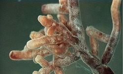Actinomyces