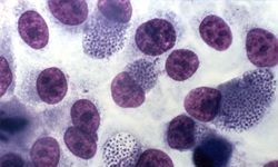 Microsporidia
