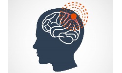 Meningitis